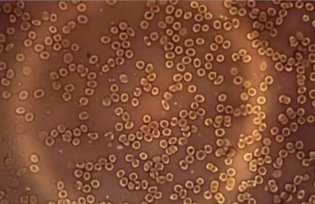 Blood cell normal