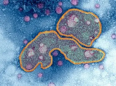 tem-avian-virus-influenza_n.jpg