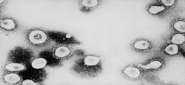 corona_virus_31_03_2013.jpg