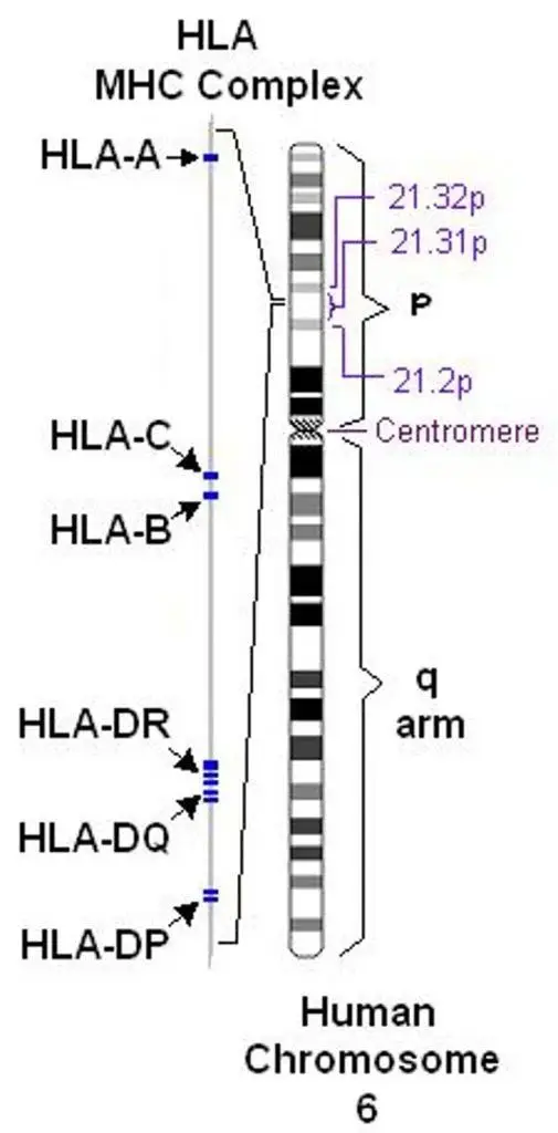 HLA 2
