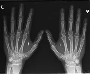handchip_300.jpg