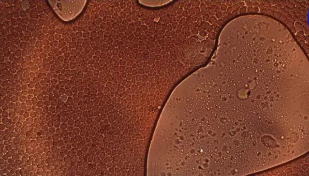 unvaccined blood cell