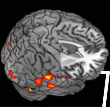 cerveau_deprime_large.jpg