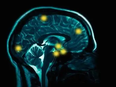 cerveau-scan,V-1-259021-3.jpg