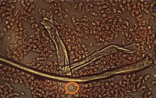 damaged blood cell