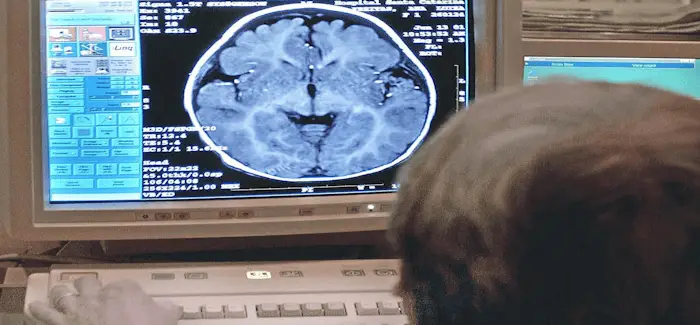 Cognitive busy 20 05 2016