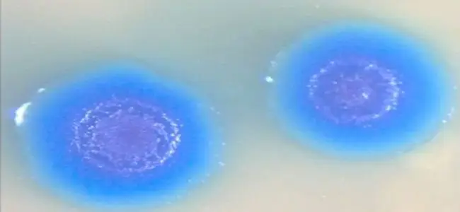 Mycoplasma_genitalium.jpg