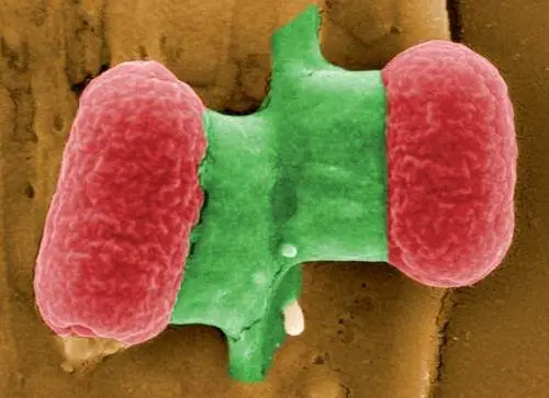 e-coli-bubonic-plague.jpg