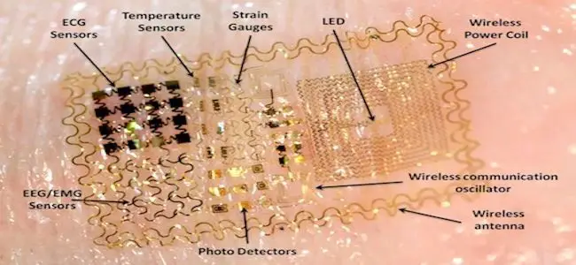 Patch_electronique_24_02_2013.jpg